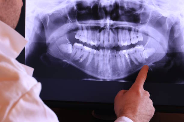 Best Emergency Dental Extractions in Manchester, PA